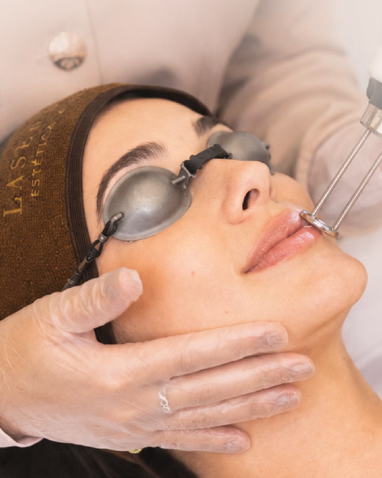 Sessão de Lip Glow nos lábios na Laser & Co